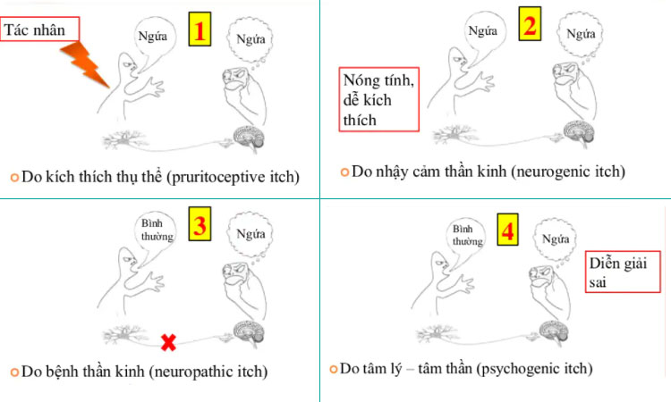 Ngứa lòng bàn tay, chân  xảy ra như thế nào? 2