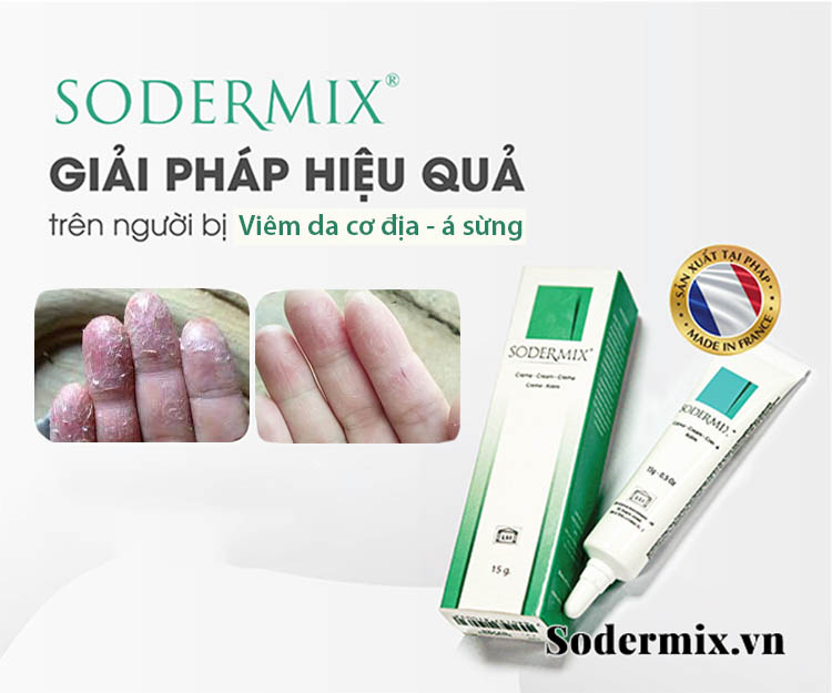 Mua Sodermix của Pháp trị viêm da cơ địa ở đâu? Giá bao nhiêu?