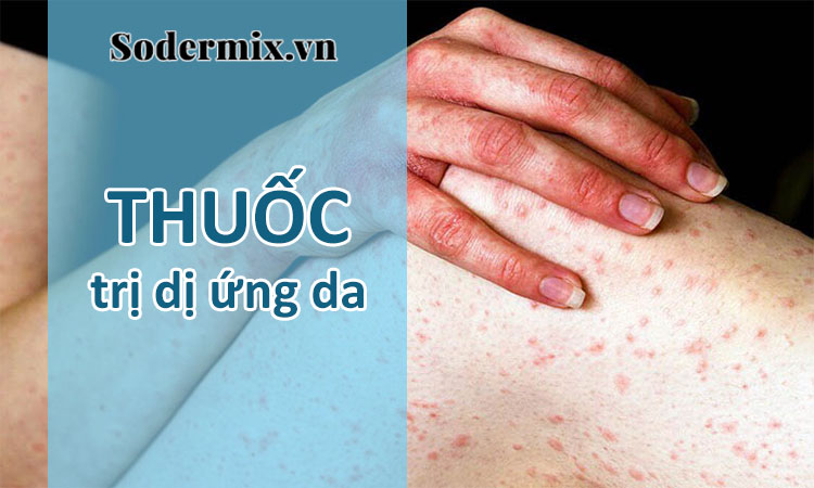 Thuốc trị dị ứng ngứa da loại nào tốt?