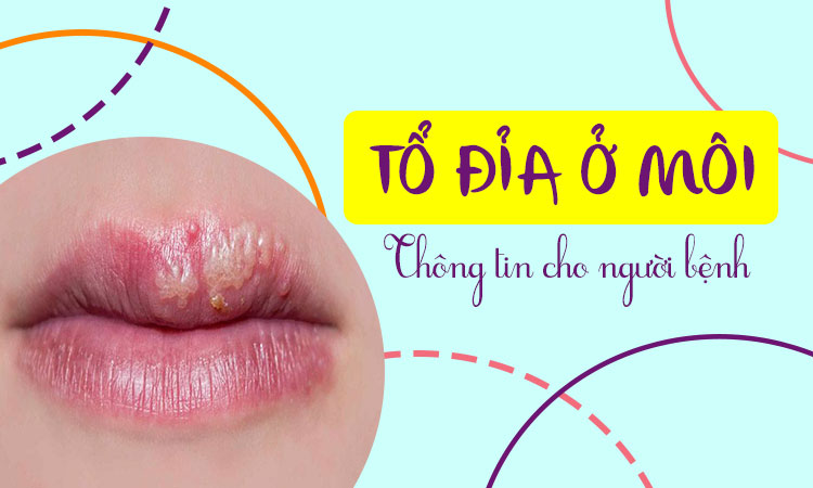 Tổ đỉa ở môi gây khó chịu? Tìm hiểu ngay!