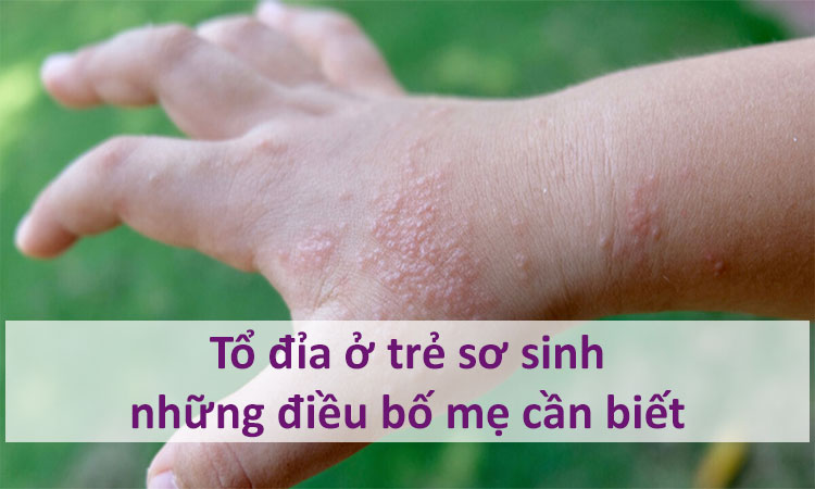 Tổ đỉa ở trẻ sơ sinh nguy hiểm hơn? - Điều cha mẹ cần biết!