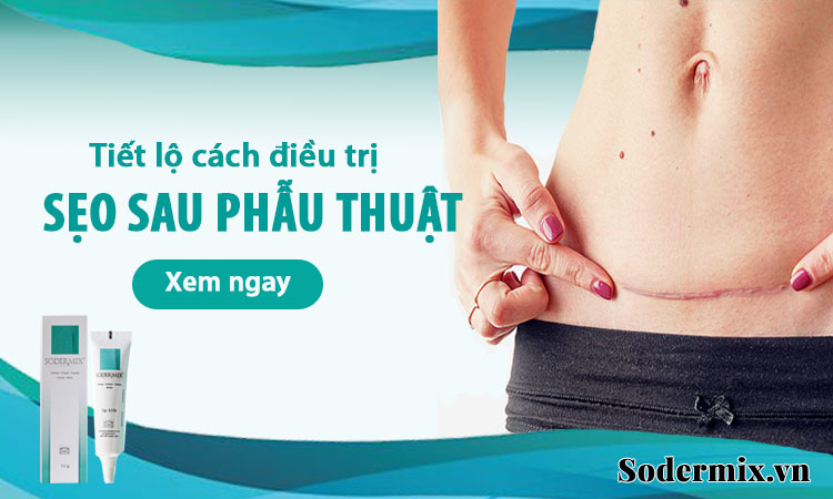 Trị sẹo lồi sau phẫu thuật: Bạn cần nhiều hơn một cách chữa!