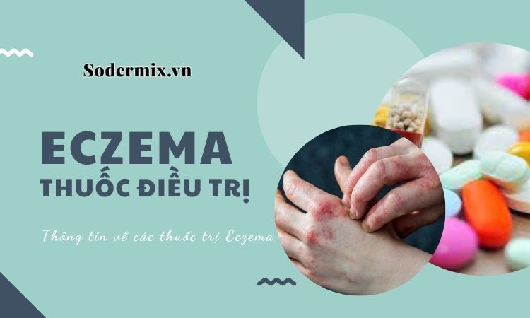 Thuốc trị Eczema có những loại nào, cách sử dụng?